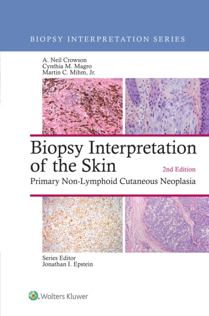 Biopsy Interpretation of the Skin : Primary Non-Lymphoid Cutaneous Neoplasia, EPUB eBook