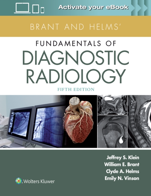 Brant and Helms' Fundamentals of Diagnostic Radiology, Hardback Book