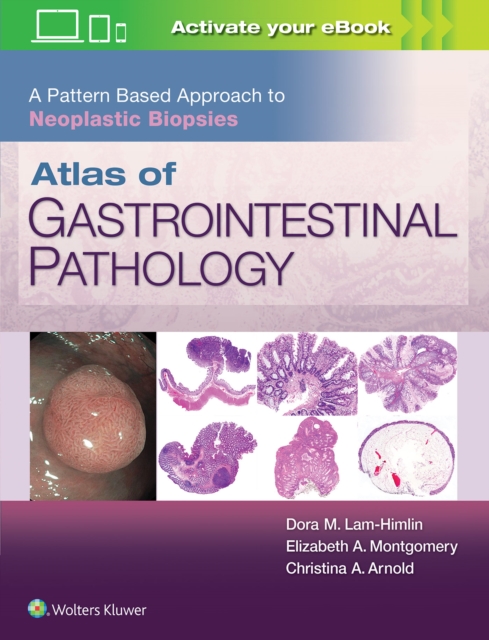 Atlas of Gastrointestinal Pathology: A Pattern Based Approach to Neoplastic Biopsies, Hardback Book