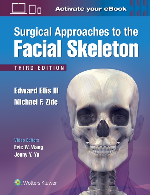 Surgical Approaches to the Facial Skeleton, Hardback Book
