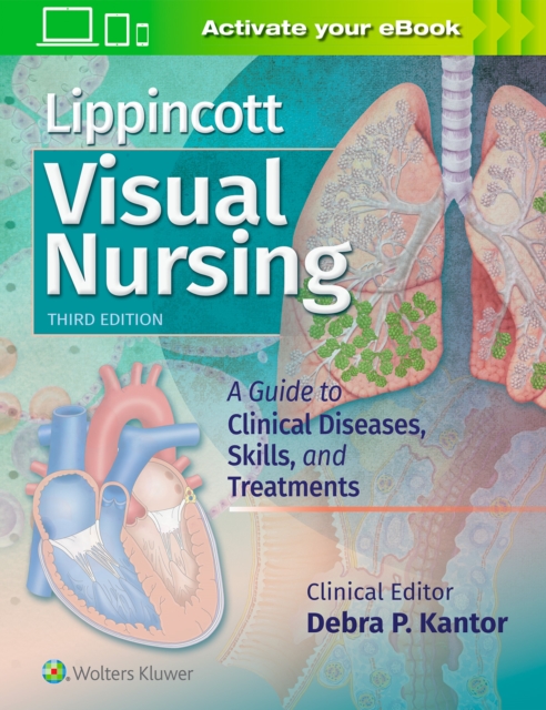 Lippincott Visual Nursing : A Guide to Clinical Diseases, Skills, and Treatments, Paperback / softback Book