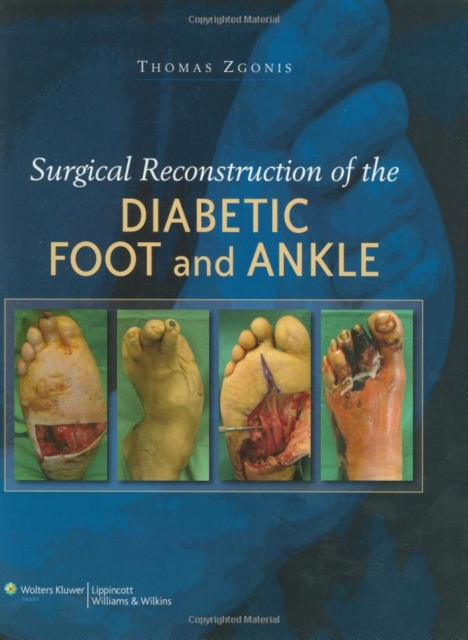 Surgical Reconstruction of the Diabetic Foot and Ankle, EPUB eBook