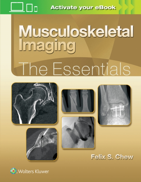 Musculoskeletal Imaging: The Essentials, Hardback Book