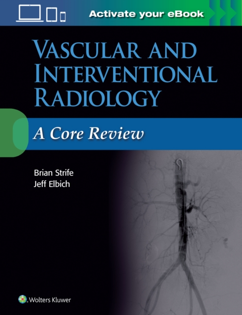 Vascular and Interventional Radiology: A Core Review, Paperback / softback Book