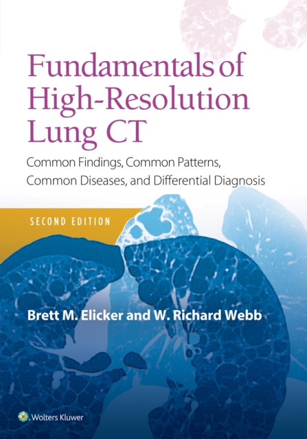 Fundamentals of High-Resolution Lung CT : Common Findings, Common Patterns, Common Diseases and Differential Diagnosis, Paperback / softback Book