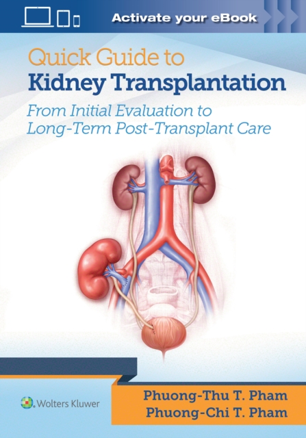 Quick Guide to Kidney Transplantation, Paperback / softback Book