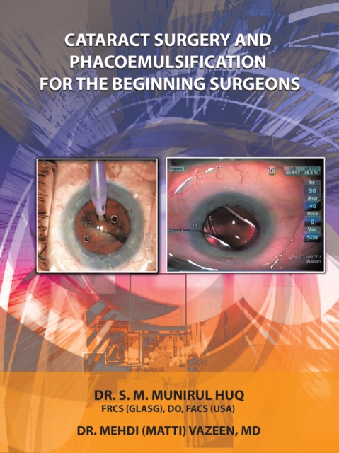 Cataract Surgery and Phacoemulsification for the Beginning   Surgeons, EPUB eBook