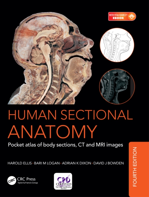 Human Sectional Anatomy : Pocket atlas of body sections, CT and MRI images, Fourth edition, PDF eBook