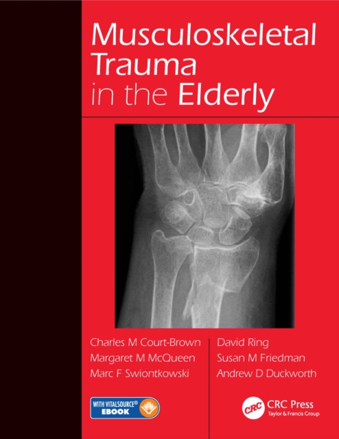 Musculoskeletal Trauma in the Elderly, EPUB eBook