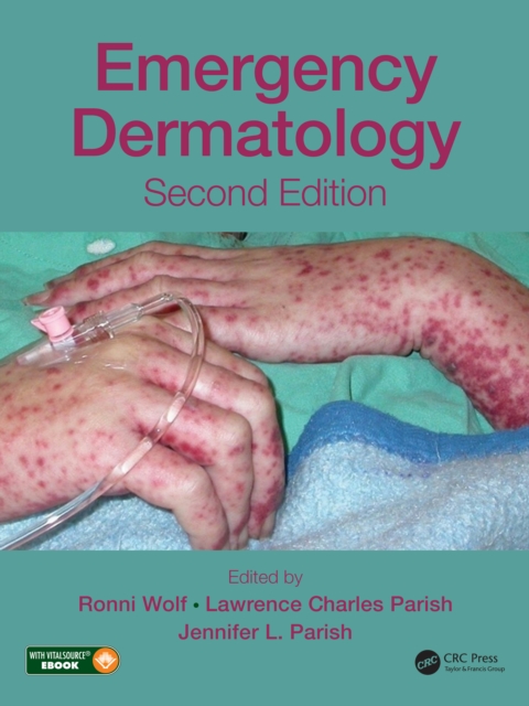 Emergency Dermatology, EPUB eBook