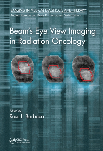 Beam's Eye View Imaging in Radiation Oncology, PDF eBook