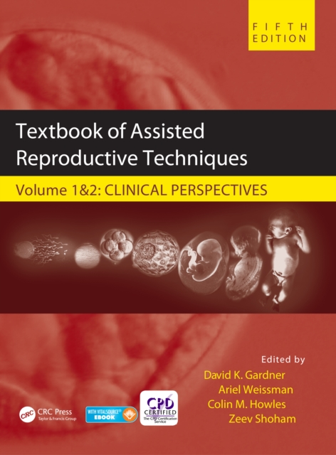 Textbook of Assisted Reproductive Techniques : Two Volume Set, EPUB eBook