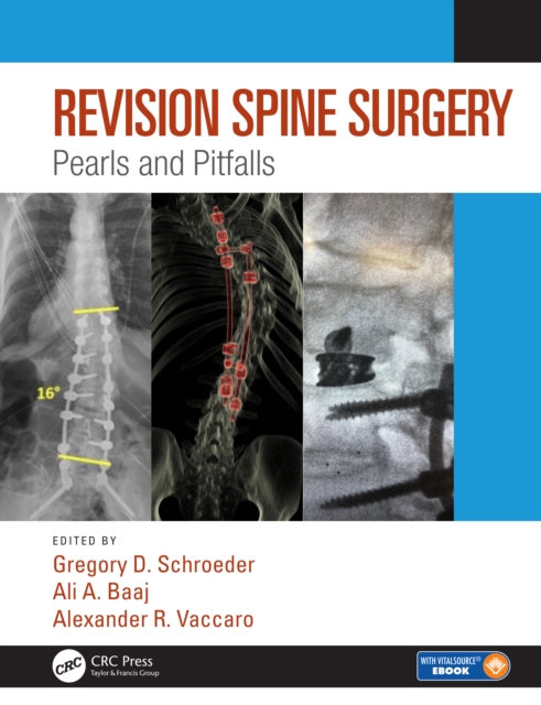 Revision Spine Surgery : Pearls and Pitfalls, PDF eBook