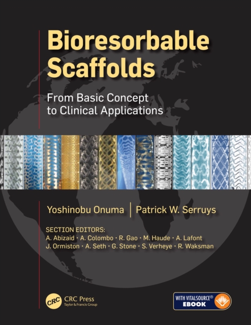 Bioresorbable Scaffolds : From Basic Concept to Clinical Applications, PDF eBook