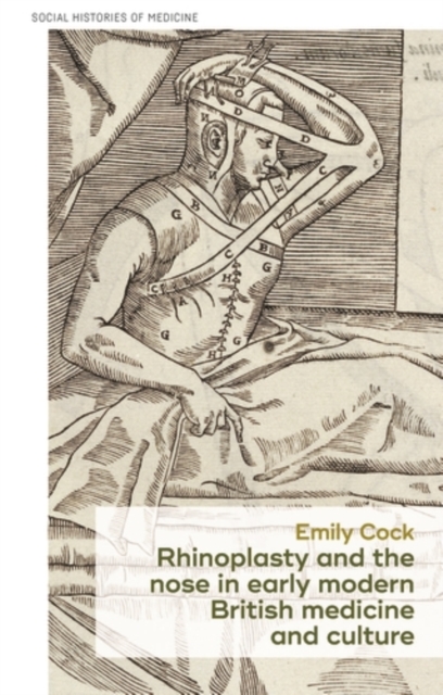Rhinoplasty and the nose in early modern British medicine and culture, EPUB eBook