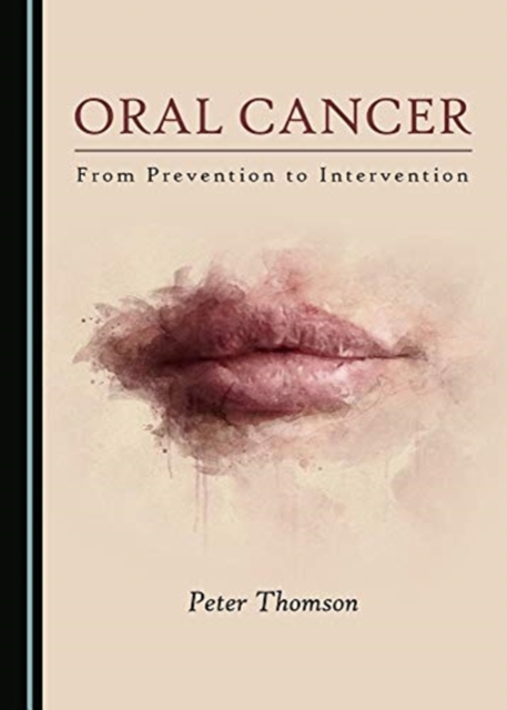 Oral Cancer : From Prevention to Intervention, Hardback Book