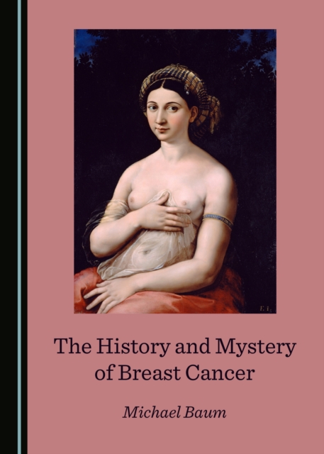 The History and Mystery of Breast Cancer, PDF eBook