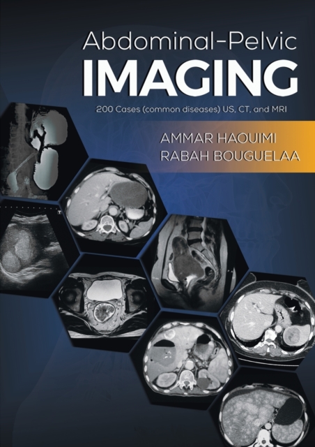 Abdominal-Pelvic Imaging : 200 Cases (Common Diseases): US, CT and MRI, Paperback / softback Book