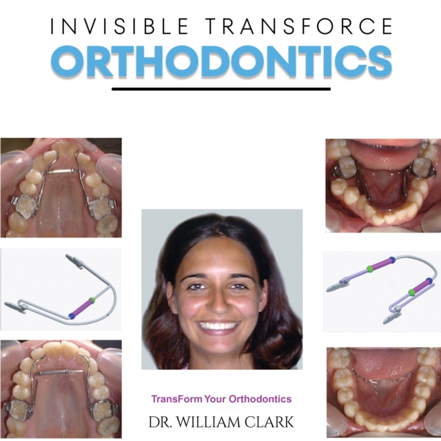 Invisible TransForce Orthodontics, Hardback Book