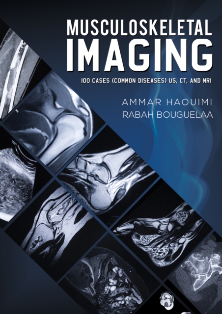 Musculoskeletal Imaging, EPUB eBook