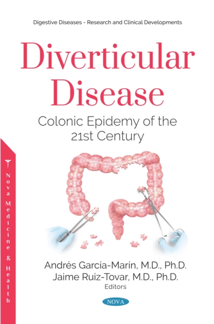 Diverticular Disease: Colonic Epidemy of the 21st Century, PDF eBook