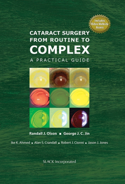 Cataract Surgery from Routine to Complex : A Practical Guide, Hardback Book