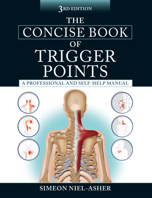 Concise Book of Trigger Points, Third Edition, EPUB eBook