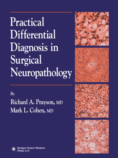 Practical Differential Diagnosis in Surgical Neuropathology, PDF eBook