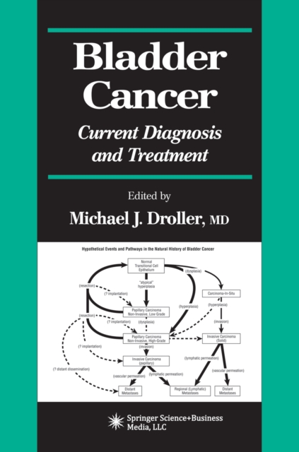 Bladder Cancer : Current Diagnosis and Treatment, PDF eBook