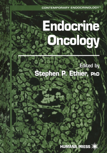 Endocrine Oncology, PDF eBook