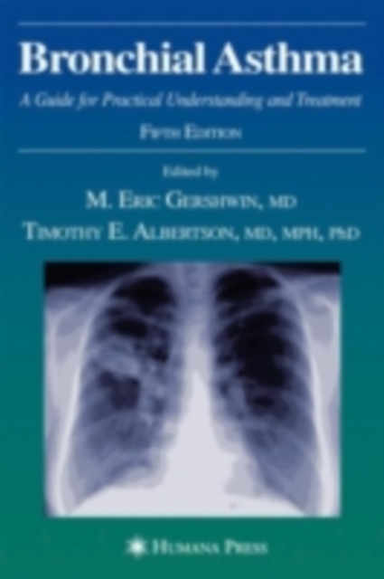 Bronchial Asthma : A Guide for Practical Understanding and Treatment, PDF eBook