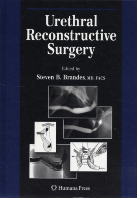 Urethral Reconstructive Surgery, PDF eBook