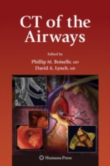 CT of the Airways, PDF eBook