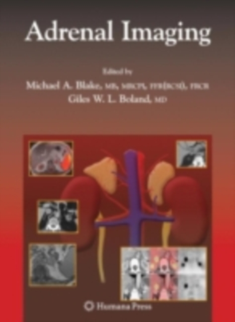 Adrenal Imaging, PDF eBook