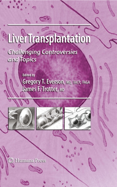 Liver Transplantation : Challenging Controversies and Topics, PDF eBook