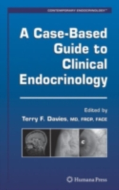 A Case-Based Guide to Clinical Endocrinology, PDF eBook