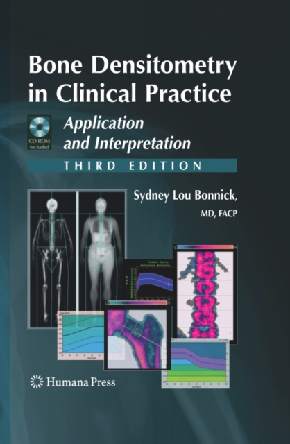 Bone Densitometry in Clinical Practice : Application and Interpretation, PDF eBook