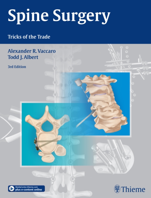 Spine Surgery : Tricks of the Trade, Hardback Book