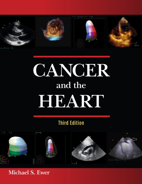 Cancer and the Heart, EPUB eBook