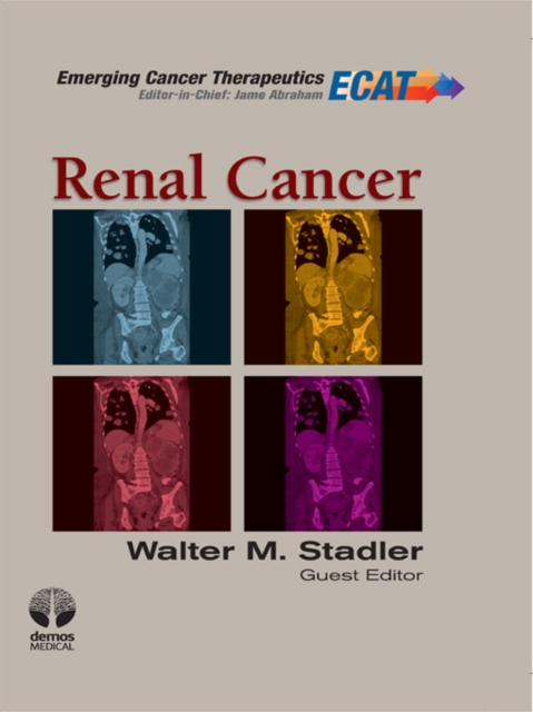 Renal Cancer, EPUB eBook
