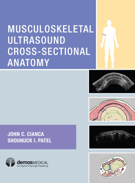 Musculoskeletal Ultrasound Cross-Sectional Anatomy, EPUB eBook