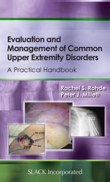 Evaluation and Management of Common Upper Extremity Disorders : A Practical Handbook, PDF eBook