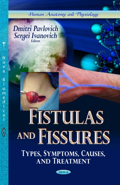 Fistulas and Fissures : Types, Symptoms, Causes, and Treatment, PDF eBook