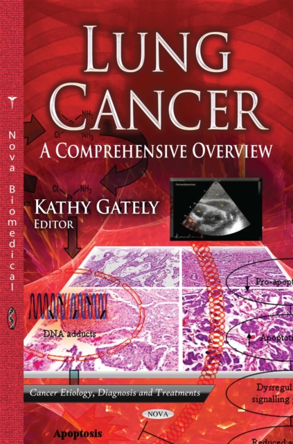 Lung Cancer : A Comprehensive Overview, PDF eBook