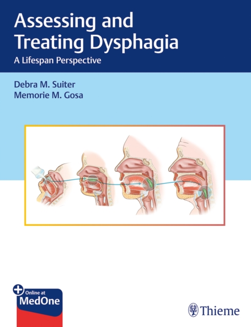 Assessing and Treating Dysphagia : A Lifespan Perspective, Multiple-component retail product, part(s) enclose Book