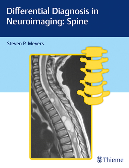 Differential Diagnosis in Neuroimaging: Spine, Hardback Book