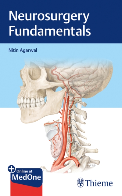 Neurosurgery Fundamentals, Mixed media product Book