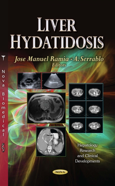 Liver Hydatidosis, PDF eBook