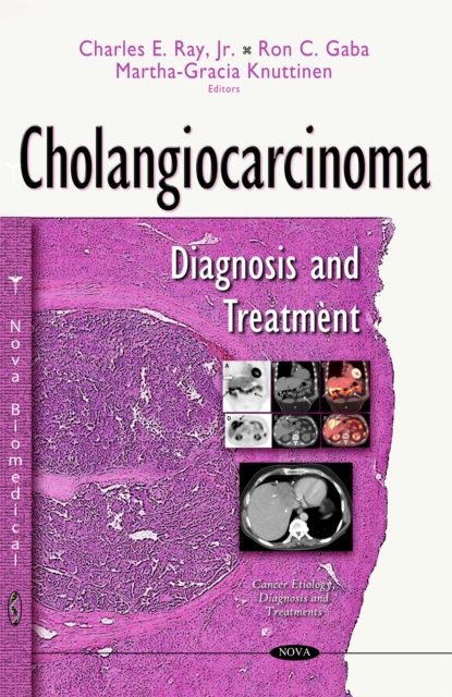 Cholangiocarcinoma : Diagnosis and Treatment, PDF eBook