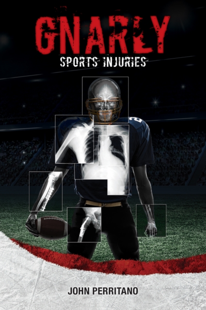 Gnarly Sports Injuries, PDF eBook